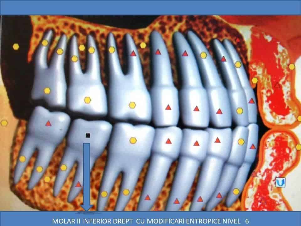 acupunctura